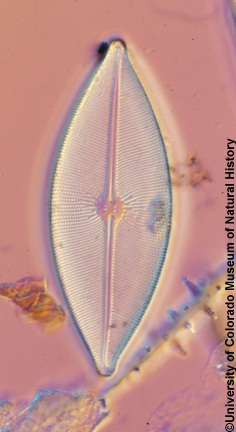 image of diatom