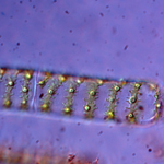 Thumbnail image of diatom